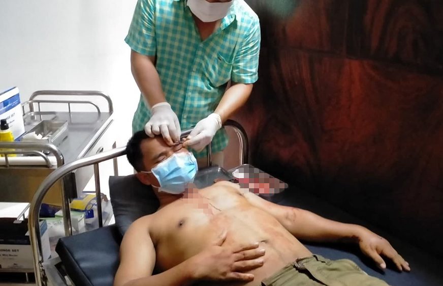 សមត្ថកិច្ច​មូលដ្ឋាន​ថា​កំពុង​ស៊ើប​អង្កេត​រក​ឃាតករ​ដែល​សម្លាប់​អតីត​សកម្មជន​គណបក្ស​ប្រឆាំង​ម្នាក់