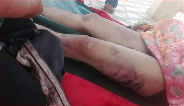 COVID-19៖ សេវាសុខាភិបាលឯកជនស្របច្បាប់បានការអនុញ្ញាតឲ្យប្រើឧបករណ៍តេស្តរហ័ស គណៈកម្មាធិការ​ជាតិ​ប្រឆាំង​ទារុណកម្ម​បដិសេធ​បង្ហាញ​របាយការណ៍​ស៊ើប​អង្កេត​ករណី​ស្លាប់​បុរស​ម្នាក់​ក្នុង​ពេល​ប៉ូលិស​ឃុំខ្លួន