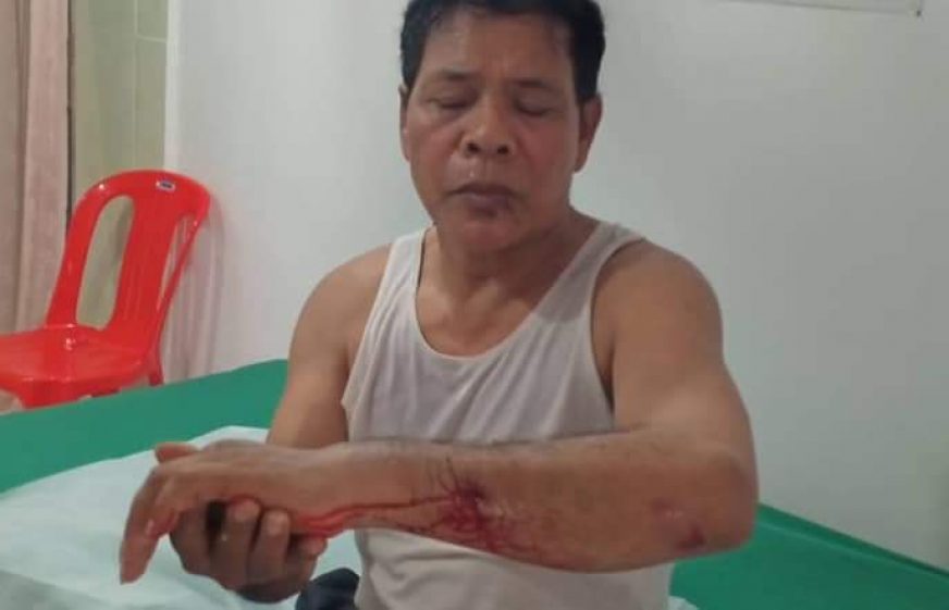 អតីតមន្ត្រី​គណបក្ស​សង្រ្គោះ​ជាតិ​ដែល​ត្រូវ​ជន​មិន​ស្គាល់​មុខ​វាយ​ នៅតែ​បារម្ភ​ពី​សុវត្ថិភាព