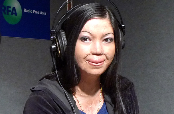 HRW: រដ្ឋាភិបាល​កម្ពុជា​បរាជ័យ​ក្នុង​ការ​អនុវត្ត​ច្បាប់​ស្ដីពី​ការ​គ្រប់គ្រង​អាស៊ីដ​ខ្លាំង និង​​​ការ​ធានា​ផ្ដល់​ការ​ព្យាបាល​ជន​រងគ្រោះ