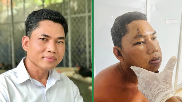 សាលាដំបូង​រាជធានី​ភ្នំពេញ​បដិសេធ​សំណើសុំ​នៅ​ក្រៅ​ឃុំ​របស់​លោក នី ណាក់