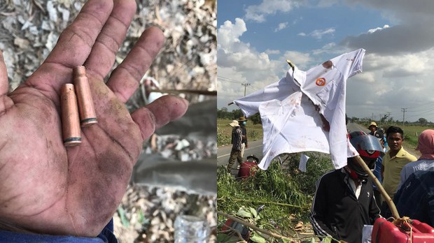 បុរស​រង​​គ្រោះ​​ដោយ​​សារ​យោធា​​បាញ់​​ក្នុង​ជម្លោះ​ដីធ្លី​នៅ​​ស្រុក​​អង្គ​ស្នួល​​បន្ត​ស្នើ​ស្ថាប័ន​ពាក់ព័ន្ធ​ពន្លឿន​ផ្តល់​​យុត្តិ​ធម៌​​