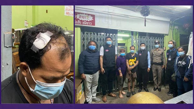 ពលករ​ខ្មែរ​ម្នាក់ ប្ដឹង​​ស្ថានទូត​ខ្មែរ​ឱ្យ​ជួយ​អន្តរាគមន៍​រឿង​ថៅកែ​ថៃ​វាយ​ក្បាល​នឹង​កាំភ្លើង​ខ្លី​របួស​ធ្ងន់