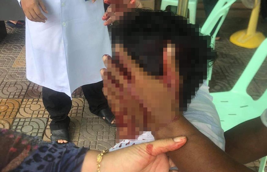 សមត្ថ​កិច្ច​កំពុង​ស្រាវ​ជ្រាវ​រក​​ជន​ល្មើស​​ដែល​គប់​ដុំ​ថ្ម​​លើ​កូន​អតីត​មន្ត្រី​បក្ស​សង្រ្គោះ​ជាតិ​បណ្តាល​ឱ្យ​​​រង​របួស​​