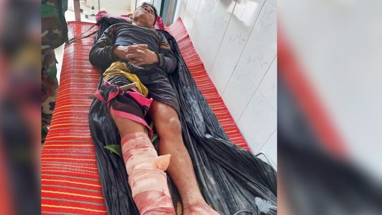 ទាហាន​ថៃបាញ់​បុរសខ្មែរ​ម្នាក់​របួស ខណៈ​ពេល​កំពុង​ឆ្លងដែ​នចូលកាប់​ឈើគ្រញូង 